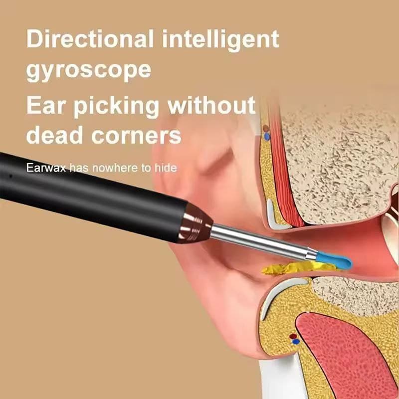 Intelligent Visual Ear Spoon